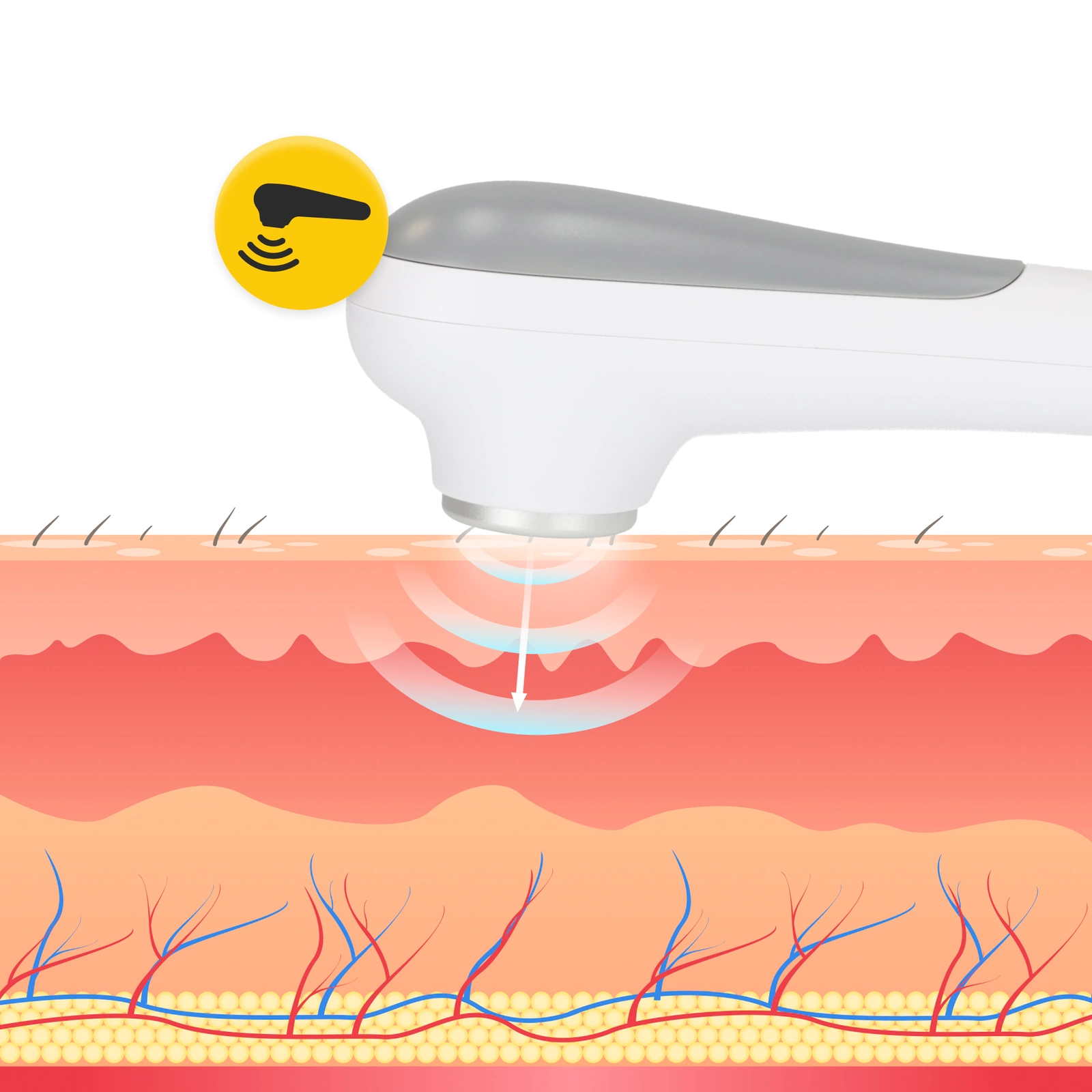 aparat ultradzwiekowy do sonoterapii manualna glowica przenosny lecznicy