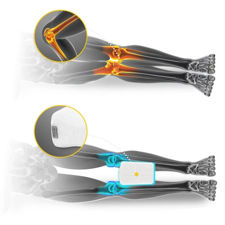 SUPPORT ortopédiai térdpárna