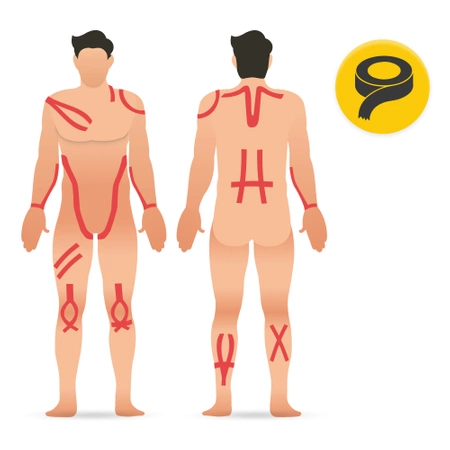 Kineziológiai tapasz Kinesio Tape, 5 m x 5 cm