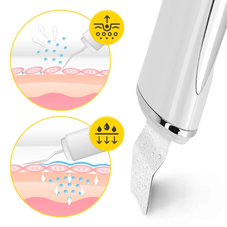 Kavitációs hámlasztó készülék